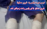 شرور مسلح با تیر پلیس رشت زمینگیر شد